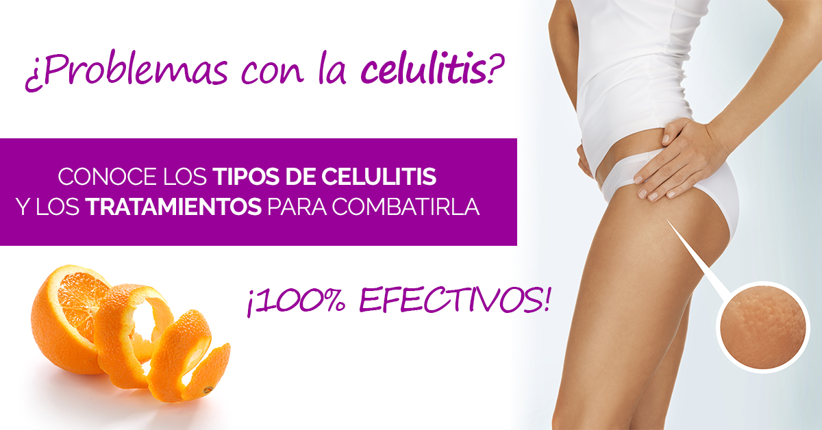 Tipos De Celulitis Centro Estético Lucía Ramírez Beauty Center